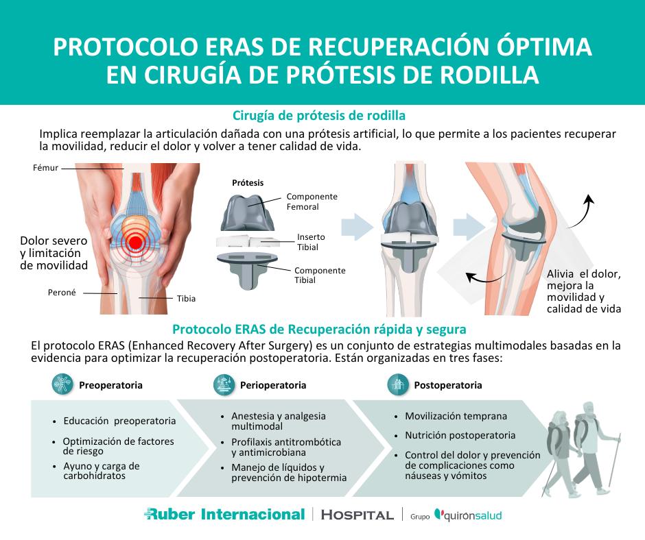Cirug a De Pr tesis De Rodilla Recuperaci n R pida Y Segura Con cirug-a-de-pr-tesis-de-rodilla-recuperaci-n-r-pida-y-segura-con